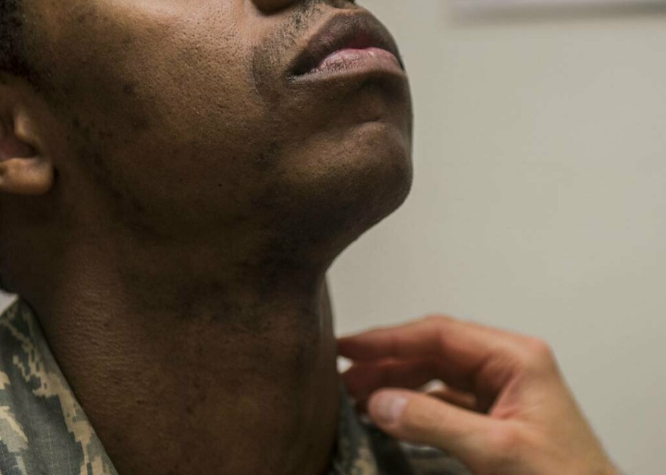 FRITAK: Dersom du sliter med «pseudofolliculitis barbae» kan ansatte i det amerikanske luftforsvaret søke om fem års barberingsfritak.