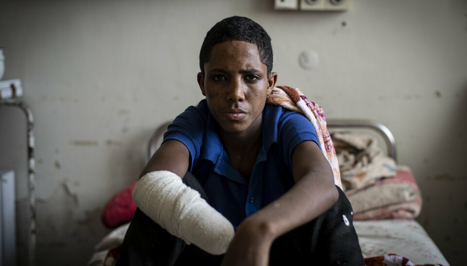 SKADET: 17 år gamle Haftom Gebretsadik mistet hånden i et artilleriangrep fra etiopiske regjeringsstyrker i Tigray i mars.