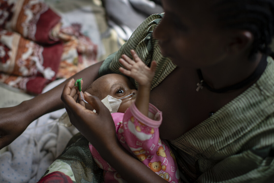 MATMANGEL: En 17 måneder gammel baby som lider av underernæring, blir matet ved hjelp av en sonde på et sykehus i Mekele i Tigray-regionen. Babyen veier kun 5,2 kilo. MATMANGEL: En 17 måneder gammel baby som lider av underernæring, blir matet ved hjelp av en sonde på et sykehus i Mekele i Tigray-regionen. Babyen veier kun 5,2 kilo.